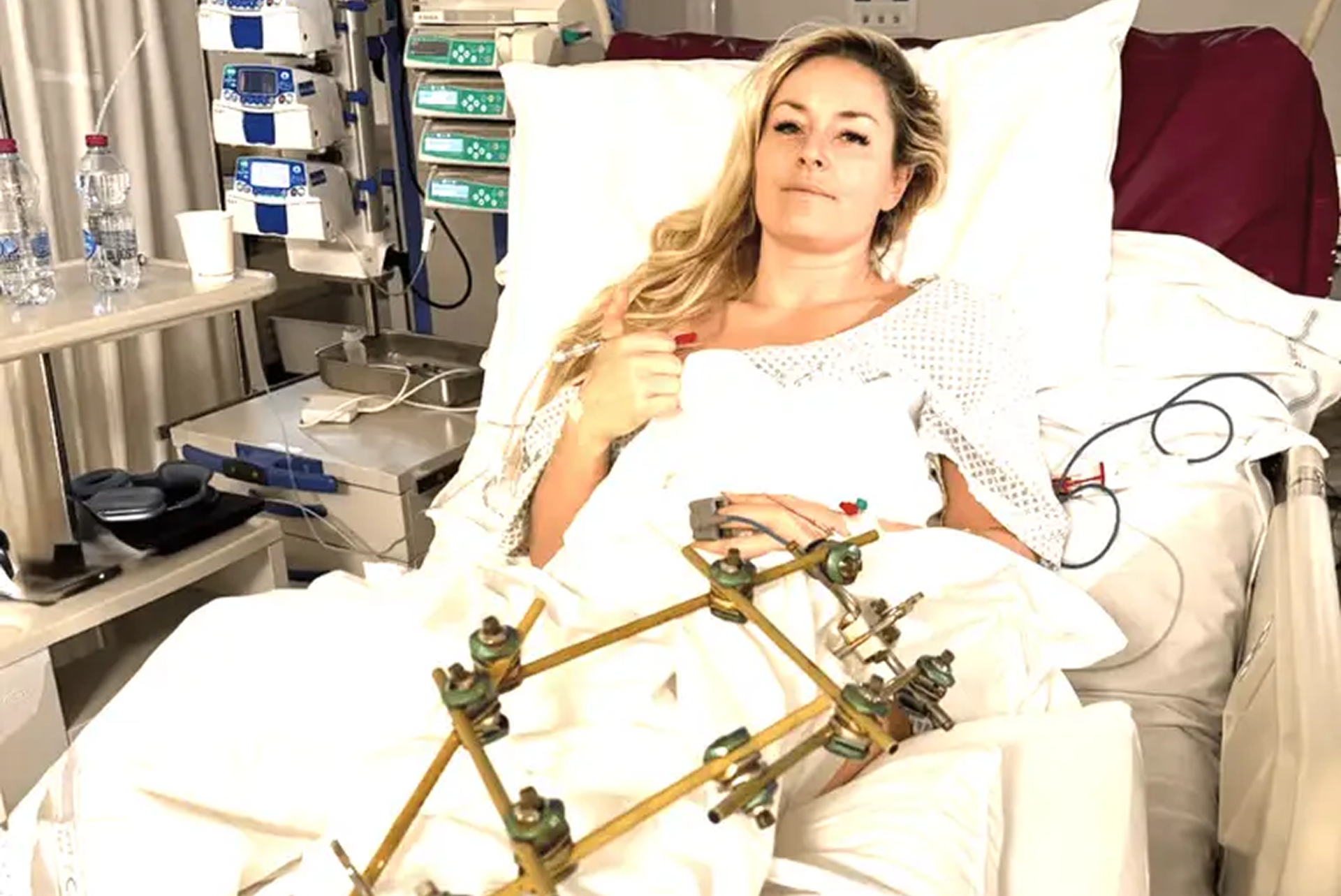 Lindsey Vonn is owning her Olympic trauma. It could be a gamechanger