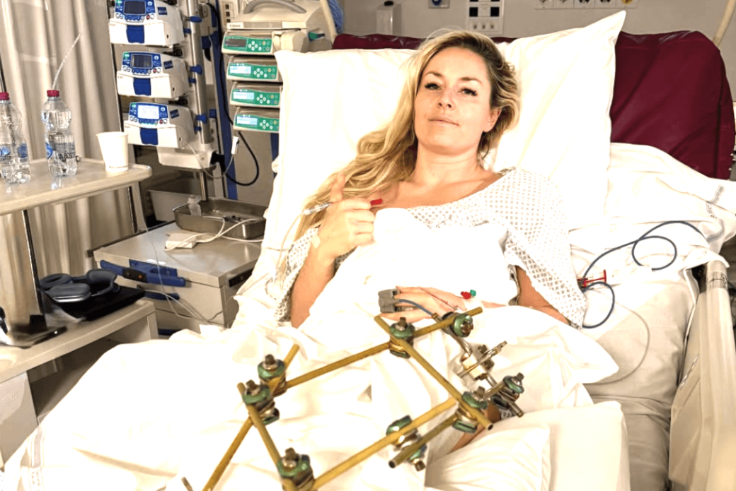 Lindsey Vonn is owning her Olympic trauma. It could be a gamechanger