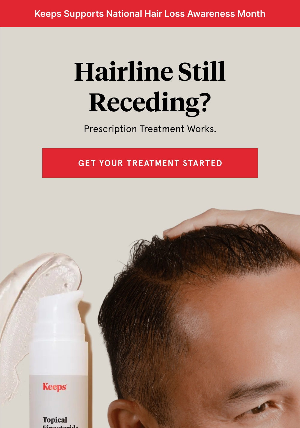 Hairline still receding? 