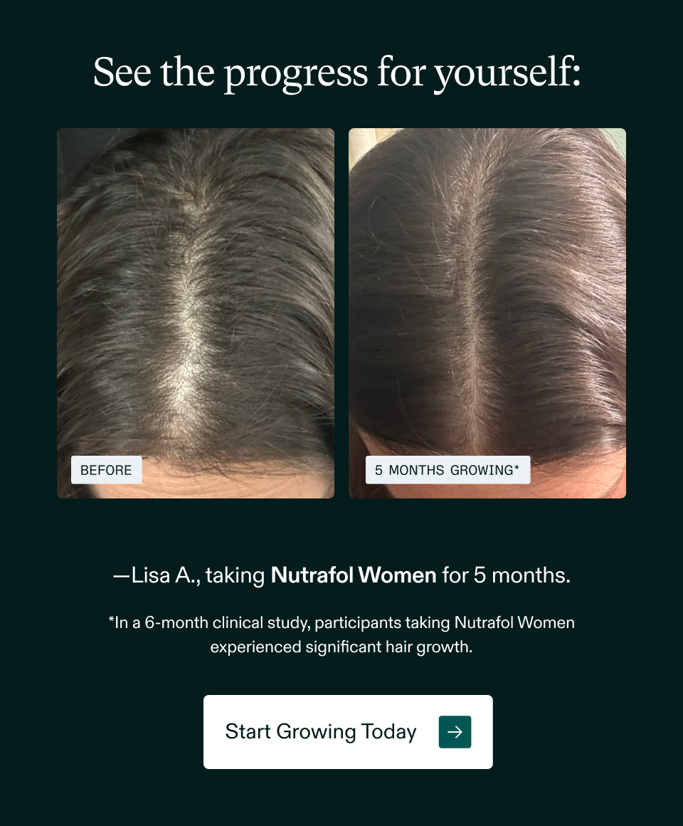 See the progress for yourself: Lisa A., taking Nutrafol Women for 5 months. *In a 6-month clinical study, participants taking Nutrafol Women experienced significant hair growth. Start Growing Today See the progress for yourself: Lisa A., taking Nutrafol Women for 5 months. *In a 6-month clinical study, participants taking Nutrafol Women experienced significant hair growth. Start Growing Today