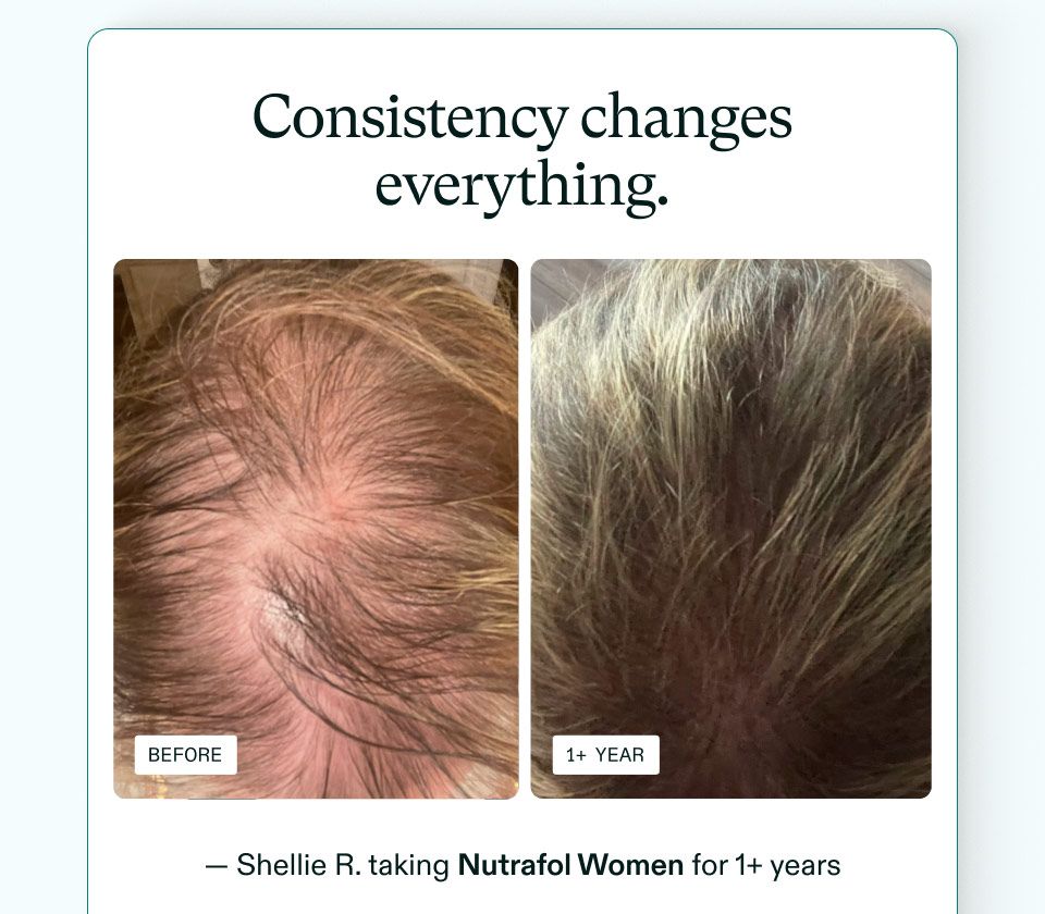 Consistency changes everything. - Shellie R. taking Nutrafol Women for 1+ years.