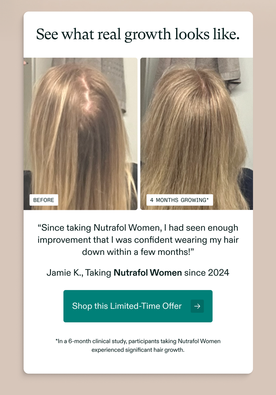 See what real growth looks like. Before 4 months growing* “Since taking Nutrafol Women, I had seen enough improvement that I was confident wearing my hair down within a few months!” Jamie K., Taking Nutrafol Women since 2024 Shop this Limited-Time Offer *In a 6-month clinical study, participants taking Nutrafol Women experienced significant hair growth. See what real growth looks like. Before 4 months growing* “Since taking Nutrafol Women, I had seen enough improvement that I was confident wearing my hair down within a few months!” Jamie K., Taking Nutrafol Women since 2024 Shop this Limited-Time Offer *In a 6-month clinical study, participants taking Nutrafol Women experienced significant hair growth.
