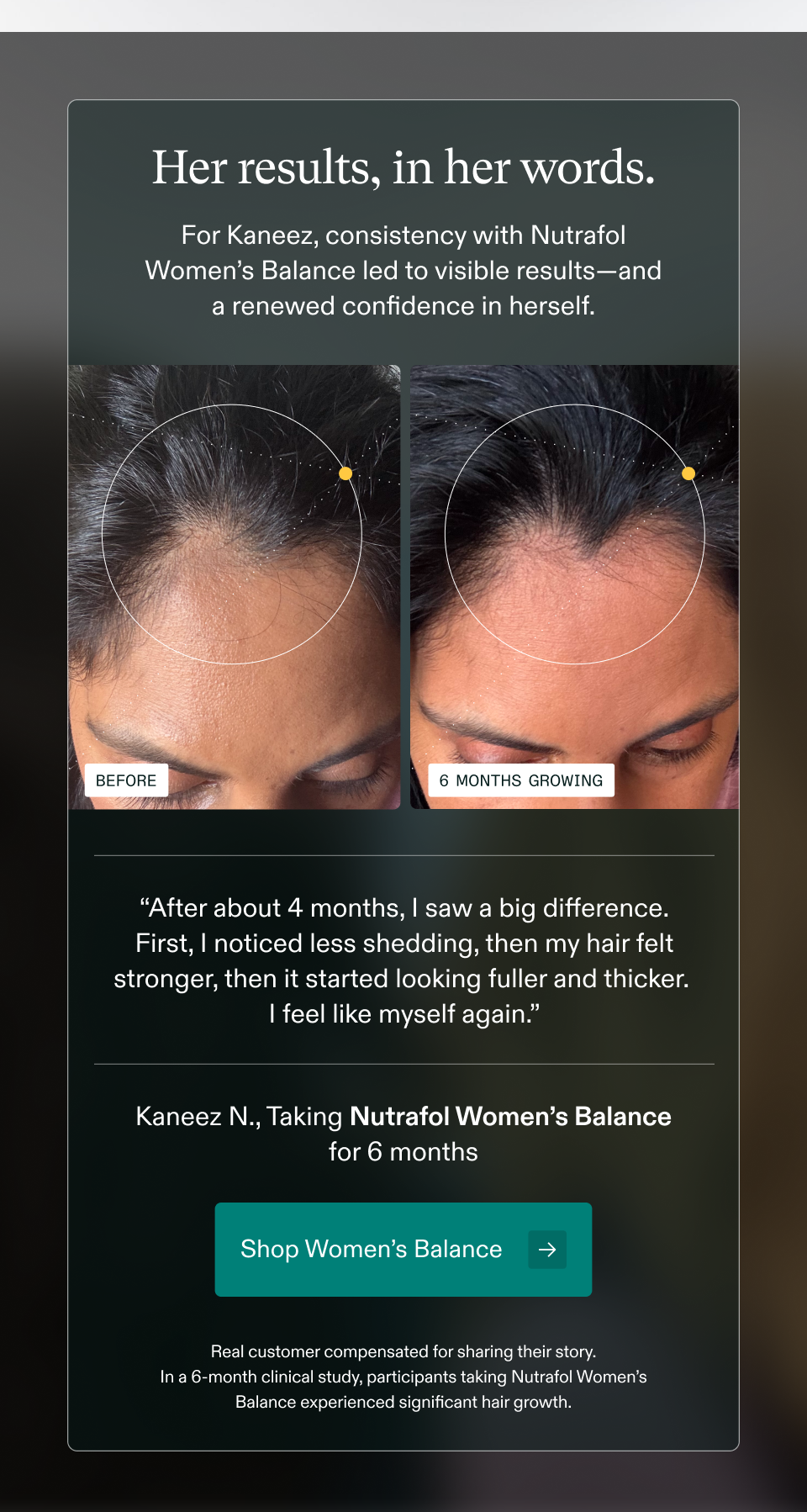Her results, in her words. For Kaneez, consistency with Nutrafol Women’s Balance led to visible results—and a renewed confidence in herself. BEFORE | 6 MONTHS GROWING “After about 4 months, I saw a big difference. First, I noticed less shedding, then my hair felt stronger, then it started looking fuller and thicker. I feel like myself again.” Kaneez N., Taking Nutrafol Women’s Balance for 6 months Shop Women’s Balance → Her results, in her words. For Kaneez, consistency with Nutrafol Women’s Balance led to visible results—and a renewed confidence in herself. BEFORE | 6 MONTHS GROWING “After about 4 months, I saw a big difference. First, I noticed less shedding, then my hair felt stronger, then it started looking fuller and thicker. I feel like myself again.” Kaneez N., Taking Nutrafol Women’s Balance for 6 months Shop Women’s Balance →