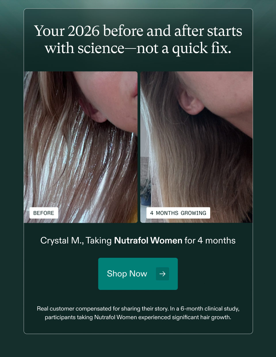 Your 2026 before and after starts with science—not a quick fix. Crystal M., Taking Nutrafol Women for 4 months. Shop Now. Real customer compensated for sharing their story. In a 6-month clinical study, participants taking Nutrafol Women experienced significant hair growth.