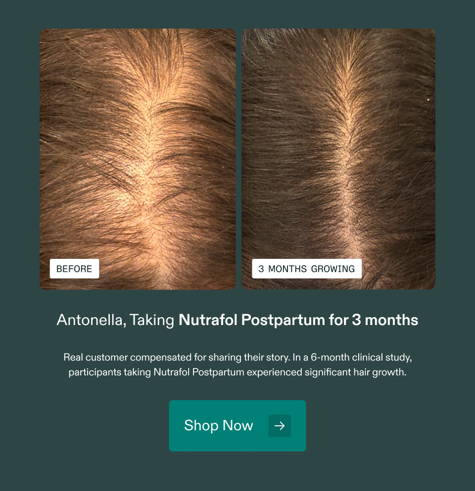 Antonella, Taking Nutrafol Postpartum for 3 months. Real customer compensated for sharing their story. In a 6-month clinical study, participants taking Nutrafol Postpartum experienced significant hair growth. Shop Now.