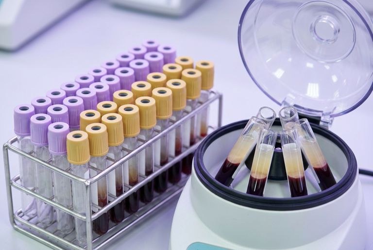 Blood sample tubes