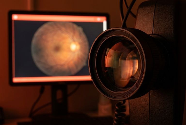 Retinal camera lens
