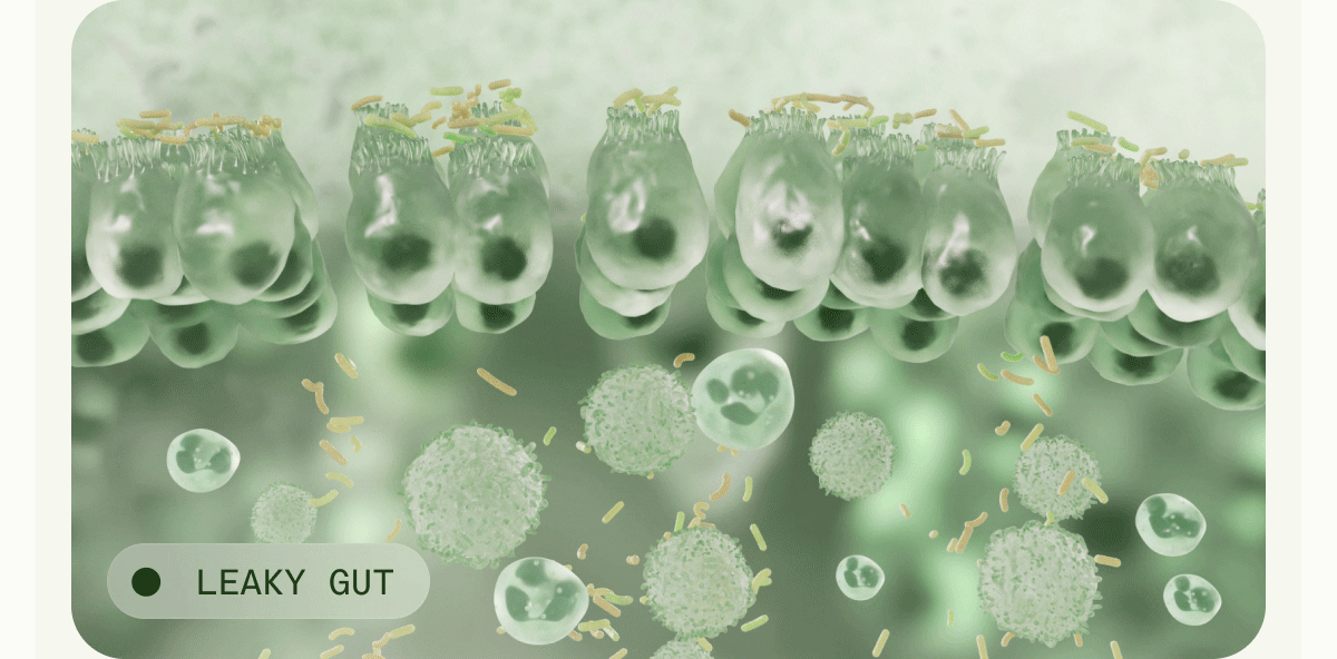 STRONG GUT | LEAKY GUT