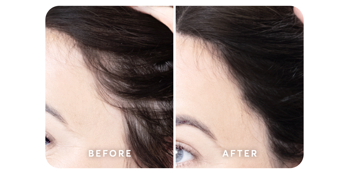 before | after