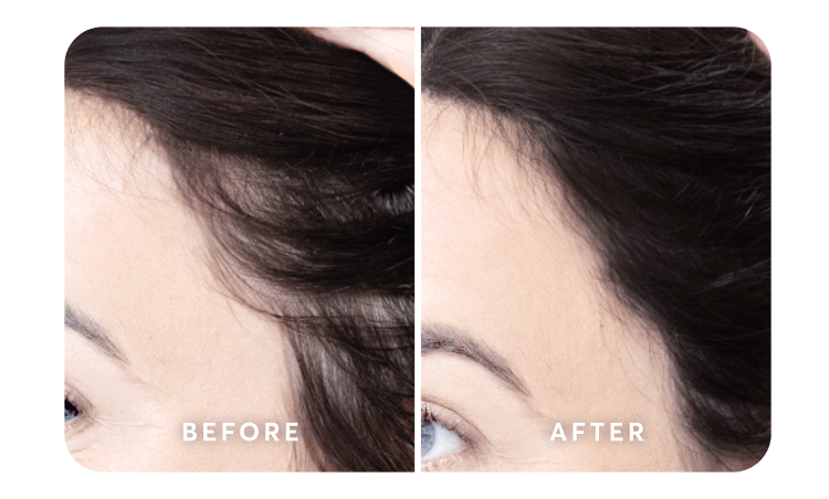 before | after