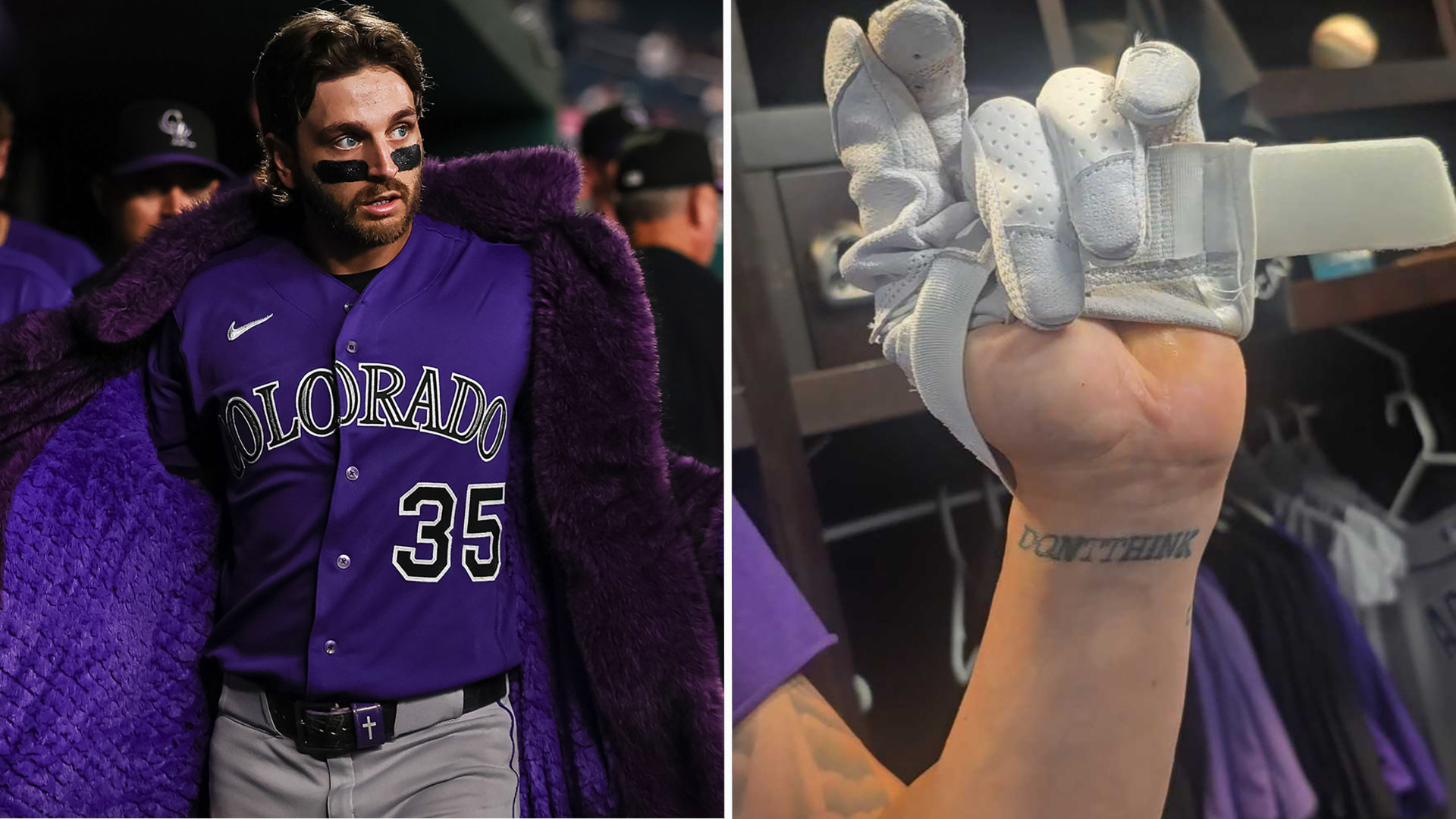 Connor Norby and his tattoo
