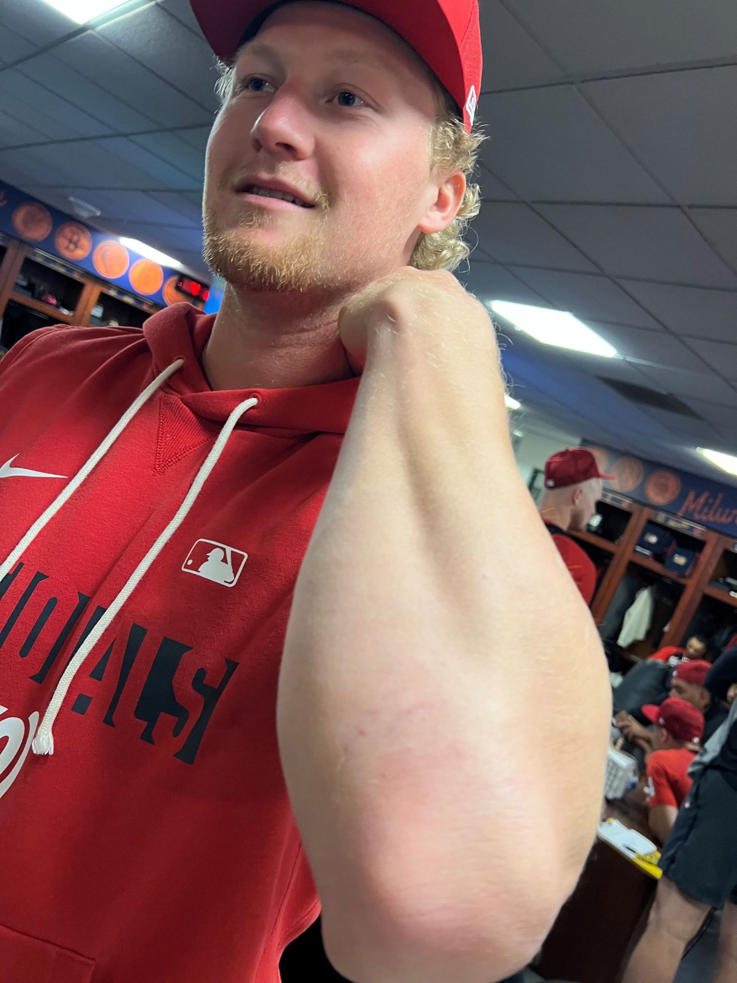 Joey Wiemer and his scar